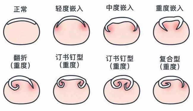 640 (1)_副本 640 (1)_副本