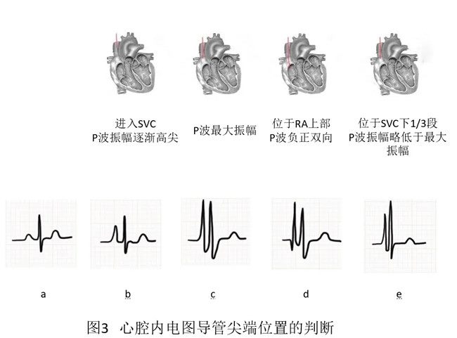 640 (6)_副本 640 (6)_副本