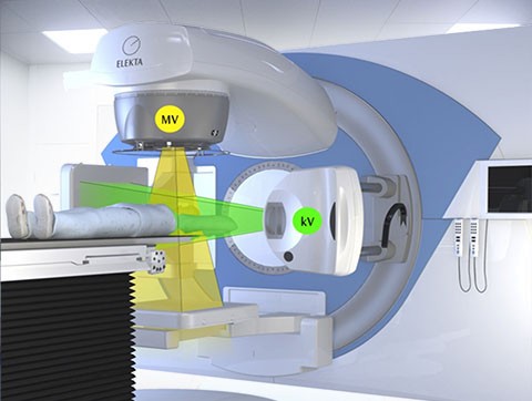 CBCT 位置验证系统